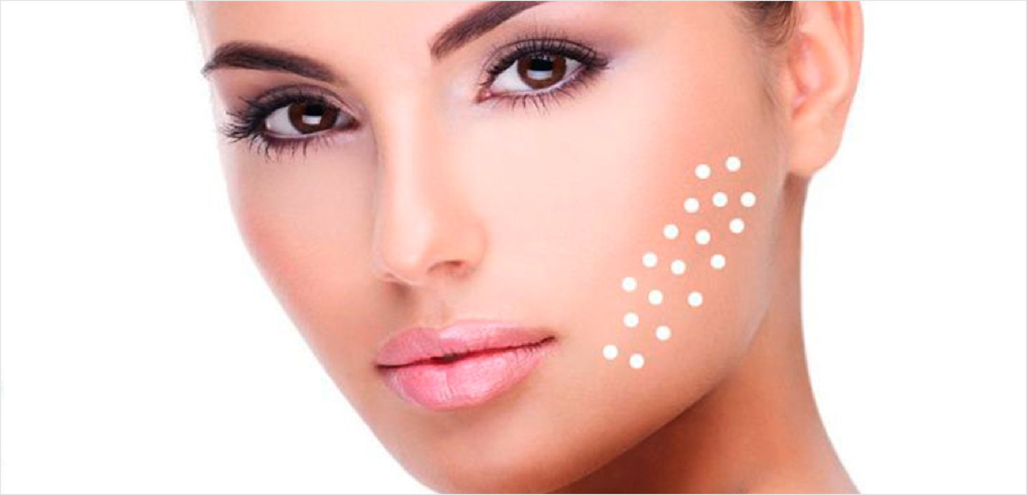 Leia mais sobre o artigo SCULPTRA